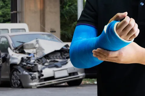 Car accident lawyer in Douglasville