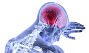 Atlanta Car Crash Lawyer