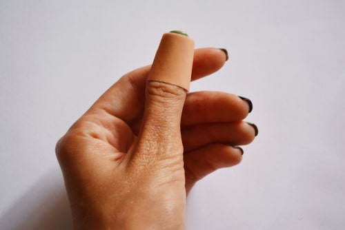 cuts & Lacerations