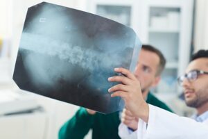 Spinal cord injuries in a car accident case