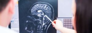traumatic brain injury-diagnosis-accident
