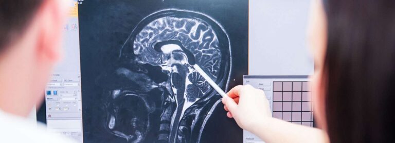 traumatic brain injury-diagnosis-accident